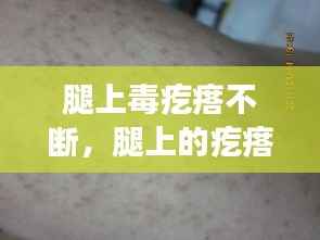 腿上毒疙瘩不断,腿上的疙瘩特别特别多为什么